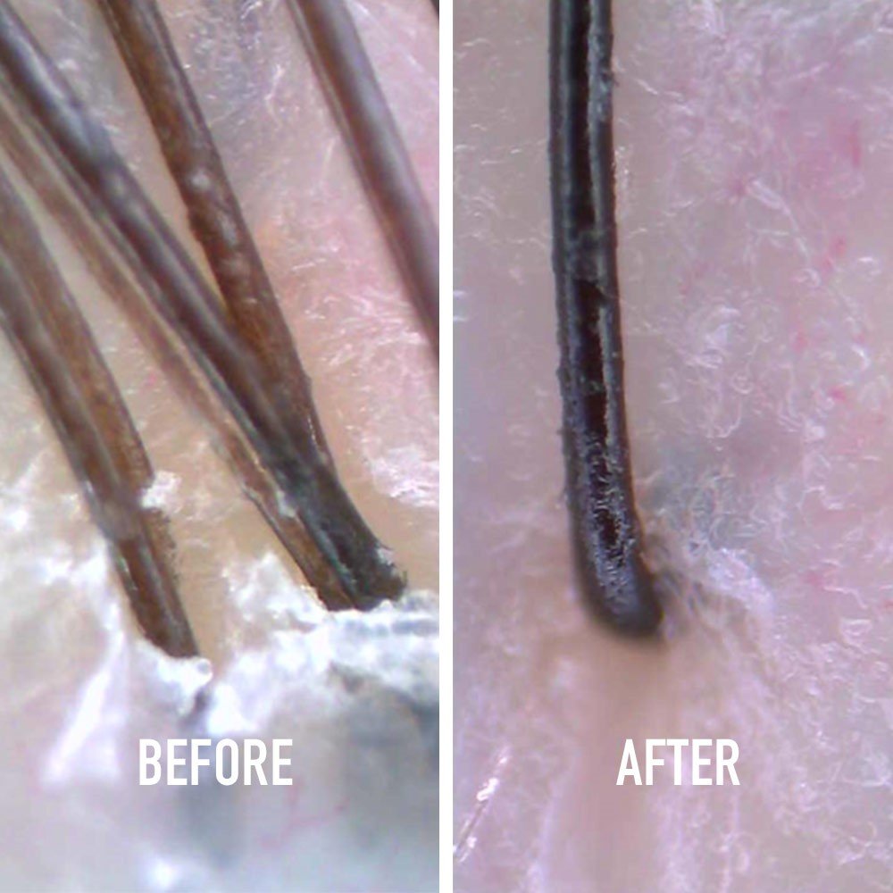 Before After Scalp Apaisant 1 Fusio Scrub Kérastase
